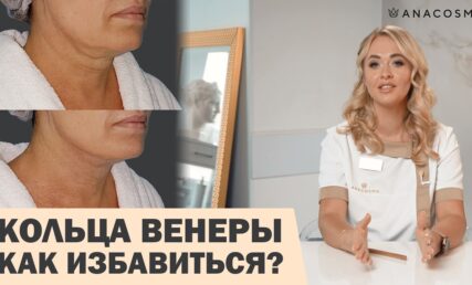 КОЛЬЦА ВЕНЕРЫ 💍 😱 КАК УБРАТЬ⁉️ МОРЩИНЫ НА ШЕЕ