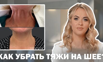 КАК УБРАТЬ ТЯЖИ НА ШЕЕ⁉️