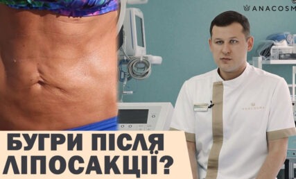 БУГРИ ПІСЛЯ ЛІПОСАКЦІЇ?