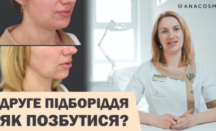 ДРУГЕ ПІДБОРІДДЯ😱🤯ЯК ПОЗБУТИСЯ⁉️