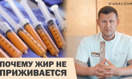 ЛИПОФИЛИНГ: ПОЧЕМУ ЖИР НЕ ПРИЖИВАЕТСЯ⁉️😭