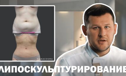 ЛИПОСКУЛЬПТУРИРОВАНИЕ 👀 ЛИПОМОДЕЛИРОВАНИЕ ТЕЛА 👀 ЧЕГО ОЖИДАТЬ⁉️