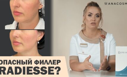 РАДИЕСС. ОПАСНЫЙ ФИЛЛЕР⁉️ ОСЛОЖНЕНИЯ РАДИЕСС 🔥