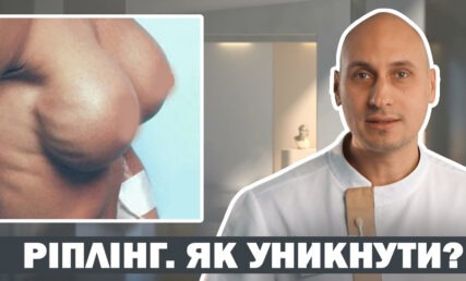 РІПЛІНГ ПІСЛЯ МАММОПЛАСТИКИ 😰 ЯК УНИКНУТИ УСКЛАДНЕНЬ⁉️