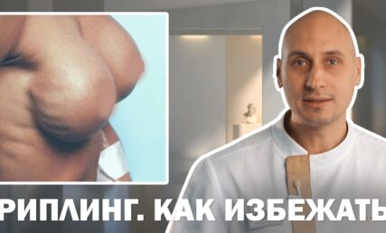 РИПЛИНГ ПОСЛЕ МАММОПЛАСТИКИ 😰 КАК ИЗБЕЖАТЬ ОСЛОЖНЕНИЙ⁉️
