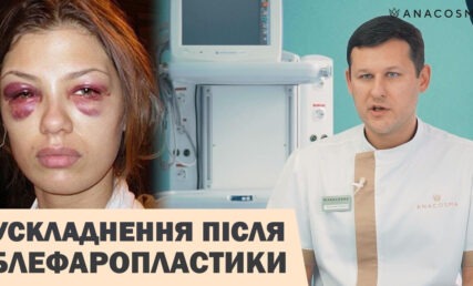 УСКЛАДНЕННЯ ПІСЛЯ БЛЕФАРОПЛАСТИКИ