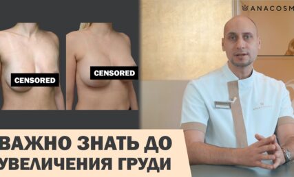 ГРУДИ ПІСЛЯ ВИГОДОВУВАННЯ?! МАМОМПЛАСТИКА ПІСЛЯ ПОЛОГІВ?