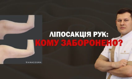 ЛІПОСАКЦІЯ РУК: КОМУ ЗАБОРОНЕНО ❗🔥 ДО ПІСЛЯ