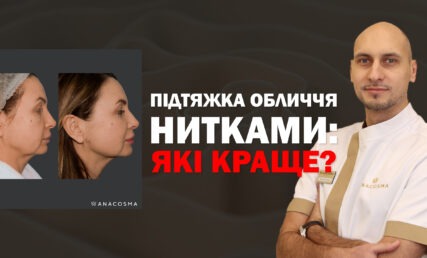ПІДТЯЖКА ОБЛИЧЧЯ НИТКАМИ🧐 ЛІГАТУРНИЙ ЛІФТИНГ VS МЕЗОНІТИ⚡️ Які краще?