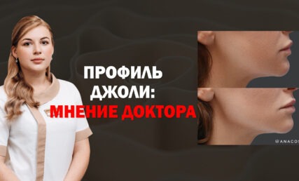 ПРОФИЛЬ ДЖОЛИ 💃🏻КОМУ ЗАПРЕЩЕНЫ УГЛЫ ДЖОЛИ?