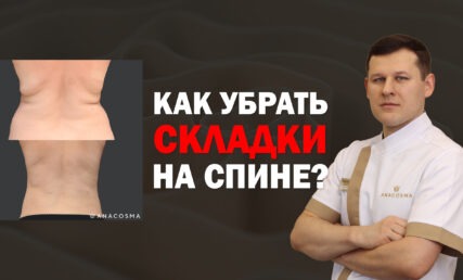 КАК УБРАТЬ СКЛАДКИ НА СПИНЕ⁉️КАК УБРАТЬ ЖИР НА СПИНЕ?🧐 ЛИПОСАКЦИЯ СПИНЫ
