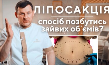 ЛІПОСАКЦІЯ – результати, ціни
