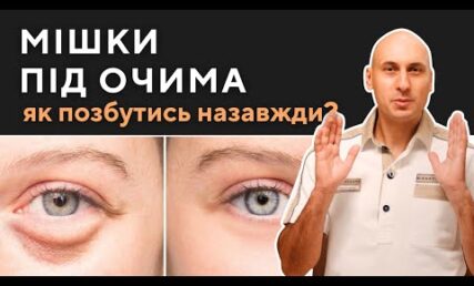 Мішки під очима - як позбутись назавжди? Чому креми не допомагають?