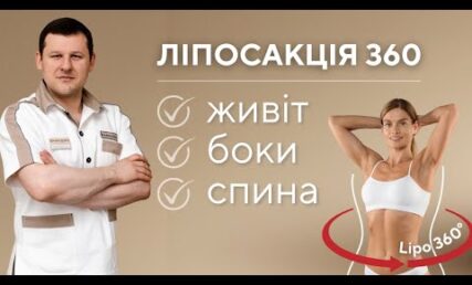 Ліпосакція 360 - переваги методу