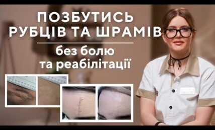 РУБЦЫ: как избавиться от боли и реабилитации?