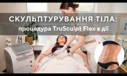 СПОРТИВНИЙ ЖИВІТ - реалізую свою мрію з TRUSCULPT FLEX
