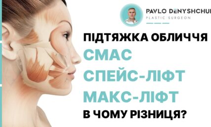 ПІДТЯЖКА ОБЛИЧЧЯ - СМАС, СПЕЙС-ЛІФТ, МАКС-ЛІФТ - В ЧОМУ РІЗНИЦЯ?