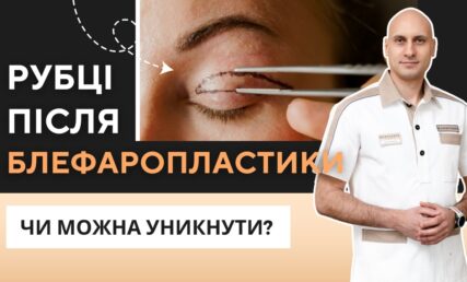 Шрами після блефаропластики: як виглядають і коли зникають?