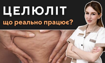 Целюліт - інноваційні та ефективні методи боротьби