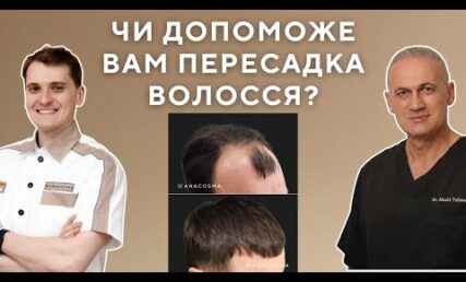 Пересадка волосся - відповіді на всі ваші питання