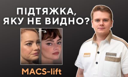 MACS-ліфт: підтяжка обличчя без ефекту маски
